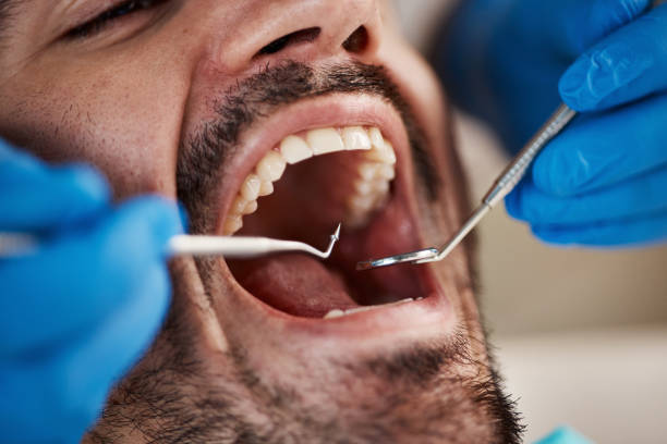 Best Weekend Emergency Dentist in Azle, TX